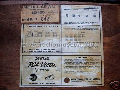 65AU RC1017A, RC1017B; RCA RCA Victor Co. (ID = 474739) Radio